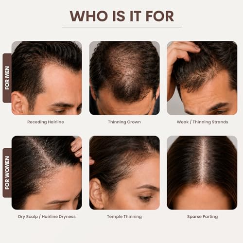 SØREN Micro Infusion Hair Renewal System by SOREN – Saw Palmetto & Peptide Scalp Treatment Kit | Supports Fuller, Thicker-Looking Hair | Gold Microinfuse Applicator | 1 Month Supply
