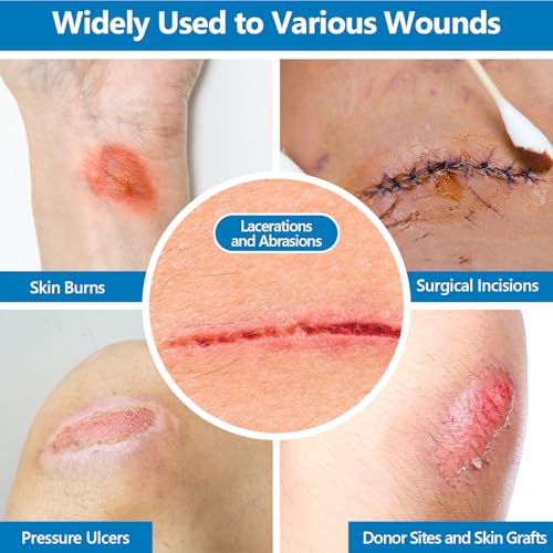 40 Pack Medical Xeroform Petrolatum Dressing Patch,4"x4"Non-Adherent Gauze Pads,Soft Fine Mesh Gauze Patch for Wound Care,Burns,Lacerations,Skin Grafts & Surgical Incisions,Individual Packaged 4"x4"