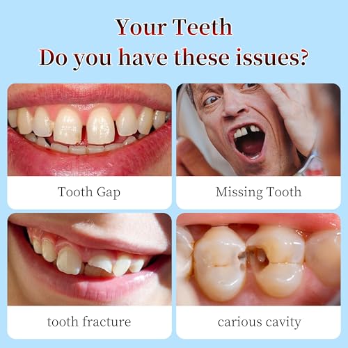 Dental Repair Kit for Gaps, Chips, Missing Teeth & Cavities - High Hardness Temporary Filling, Light Cure, Heat Resistant, DIY at Home with Tools, Natural Looking