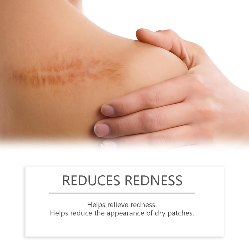 Scar Stick, Scar Solutions Silicone Scar Stick, Thick Solid Velvety Film for Old, Burn Scars, Acne, Stretch Marks, Formula Infused with Asiatica Extracts and Vitamin E for Skin Smoother, Softer