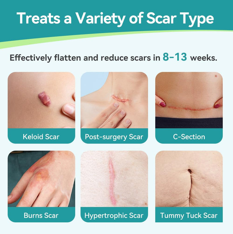 Dimora Medical Grade Silicone Scar Sheets -Ultra Soft Silicone Scar Tape (1.6‚Äùx60" Roll), Hypoallergenic Scar Removal Treatment for Surgical Scars, C Section, Tummy Tuck, Keloid Treatment scar sheet-60" - BeesActive Australia