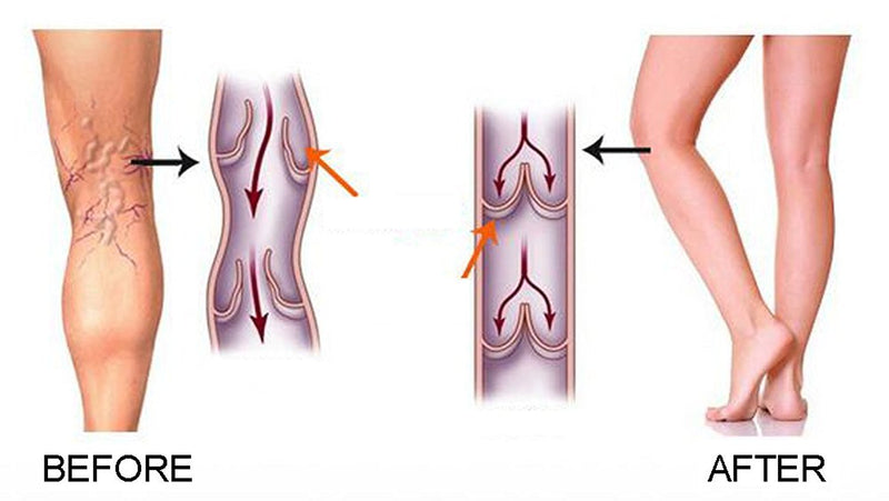 Women's Medical Compression Stockings 15-20mmhg Socks Calf Sleeve Black - BeesActive Australia
