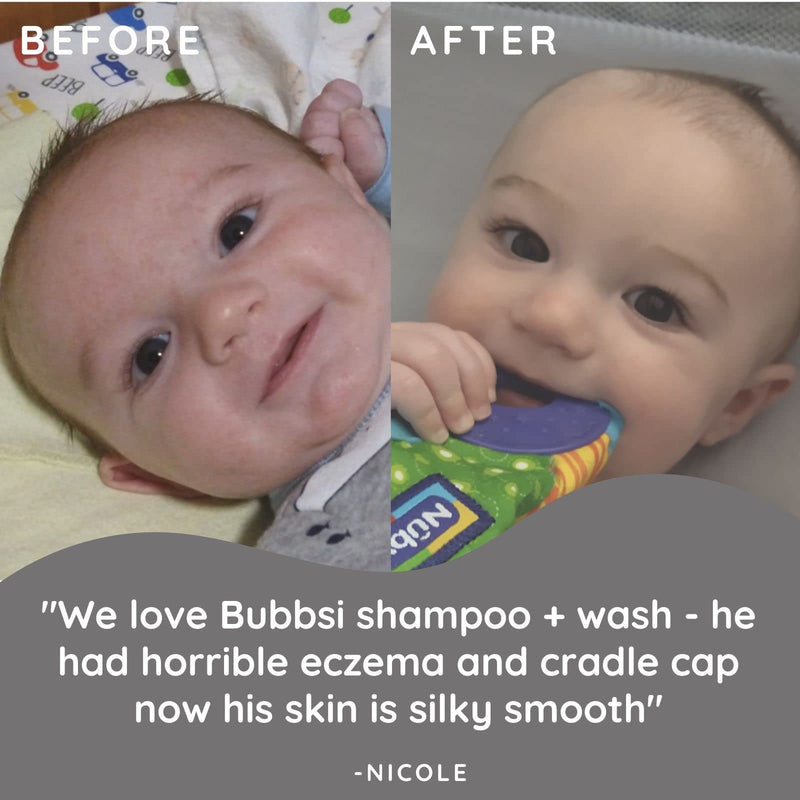 Bubbsi Creamy Coconut Oil Baby Shampoo & Wash | Light Natural Scent | Won't irritate eyes | Organic Coconut Oil + Shea | Gentle, Sulfate-free, Nourishing | Cradle Cap, Eczema (Refillable bottle, 8oz) Refillable bottle 8 Fl Oz (Pack of 1) - BeesActive Australia