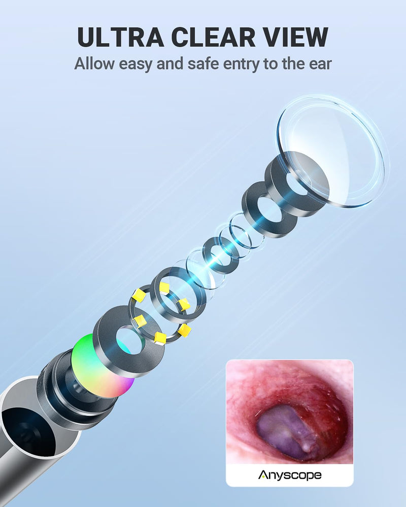 Wireless Otoscope with Gyroscope, Ear Camera with Dual View, 3.9 mm Otoscope with Light, Ear Scope with Ear Wax Removal Tool for Kids, Adults, and Pets, Compatible with iPhone and Android - BeesActive Australia