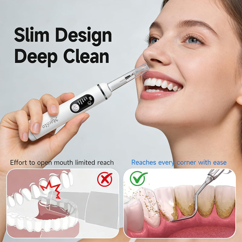 Ultimate Electric Teeth Cleaner - Ultrasonic Tooth Cleaning, Violet Light Protection, 316F Stainless Steel Heads, 5-Speed Modes, IPX6 Waterproof, Oral Care Kit with 7 Accessories‌ (White)
