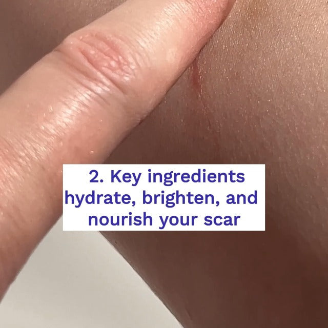 Rejuvaskin RejuvaSil Silicone Scar Gel, Scar Treatment for Surgical Scars, Burns, Keloids, Acne Scars on Face & Body, 30ml 1.01 Fl Oz (Pack of 1)