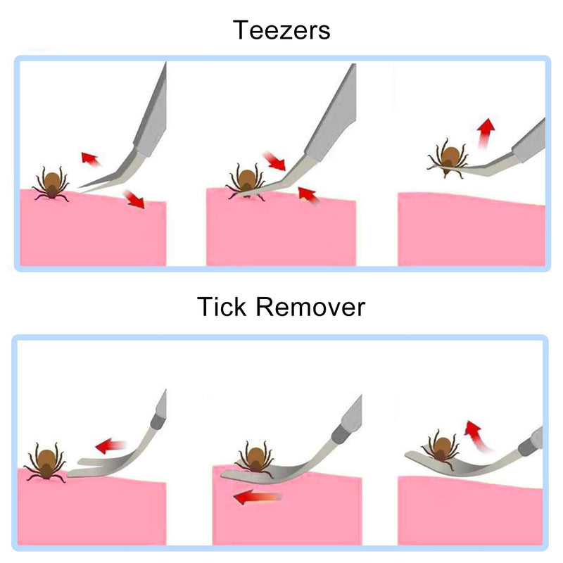 Nutabevr 2 in 1 professional stainless steel tick tweezers, easy removal of ticks of all sizes, tick remover, tick tweezers and tick hook, reliable and easy to use, for humans, dogs, cats - BeesActive Australia