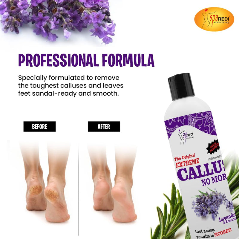 SPA REDI Callus Remover - Professional-Grade Callus Dissolving Treatment - Stop Scraping. Start Dissolving. Chemically Dissolve Toughest Buildup for a Dramatic 'Wow' Transformation 12 Oz - BeesActive Australia