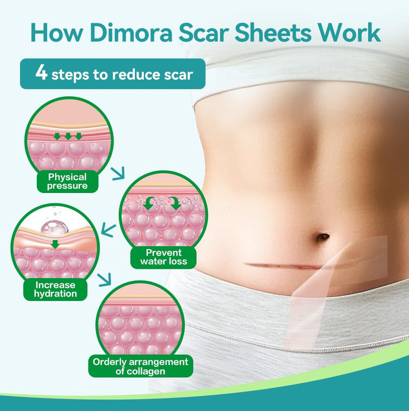 Dimora Medical Grade Silicone Scar Sheets -Ultra Soft Silicone Scar Tape (1.6‚Äùx60" Roll), Hypoallergenic Scar Removal Treatment for Surgical Scars, C Section, Tummy Tuck, Keloid Treatment scar sheet-60" - BeesActive Australia