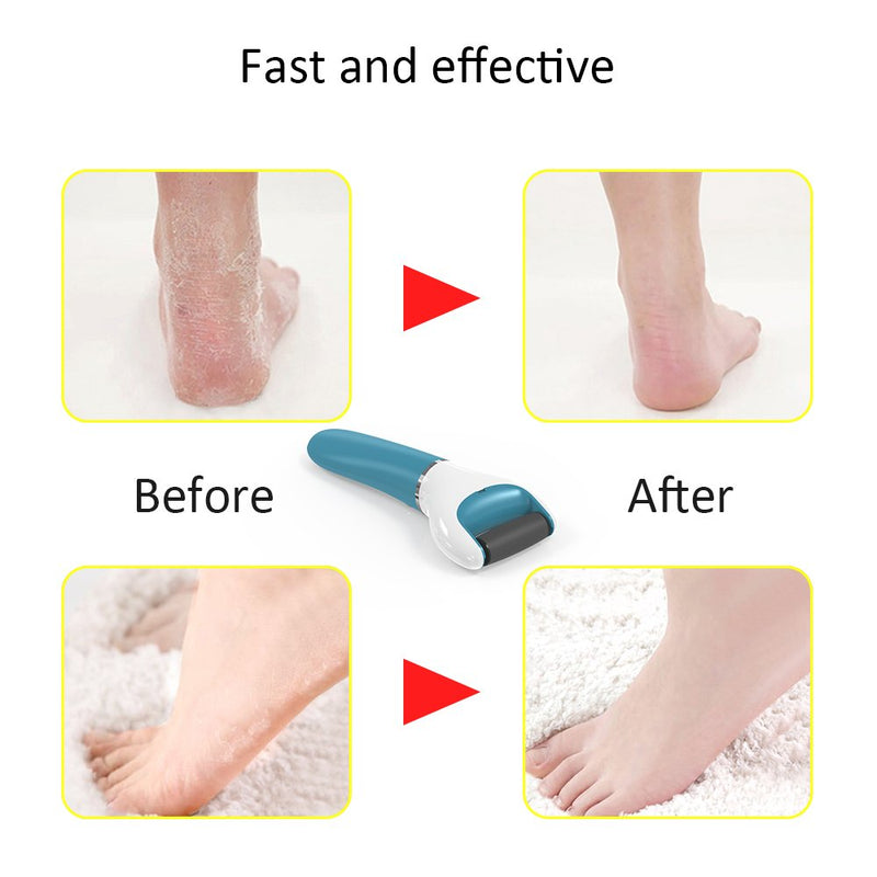 Electric Foot File Callus Remover Professional, 2-Speed Rechargeable Pedicure Tool for Remove Calluses, Dry, Hard, Dead, Cracked Skin, Includes 2 Coarses (Blue) - BeesActive Australia
