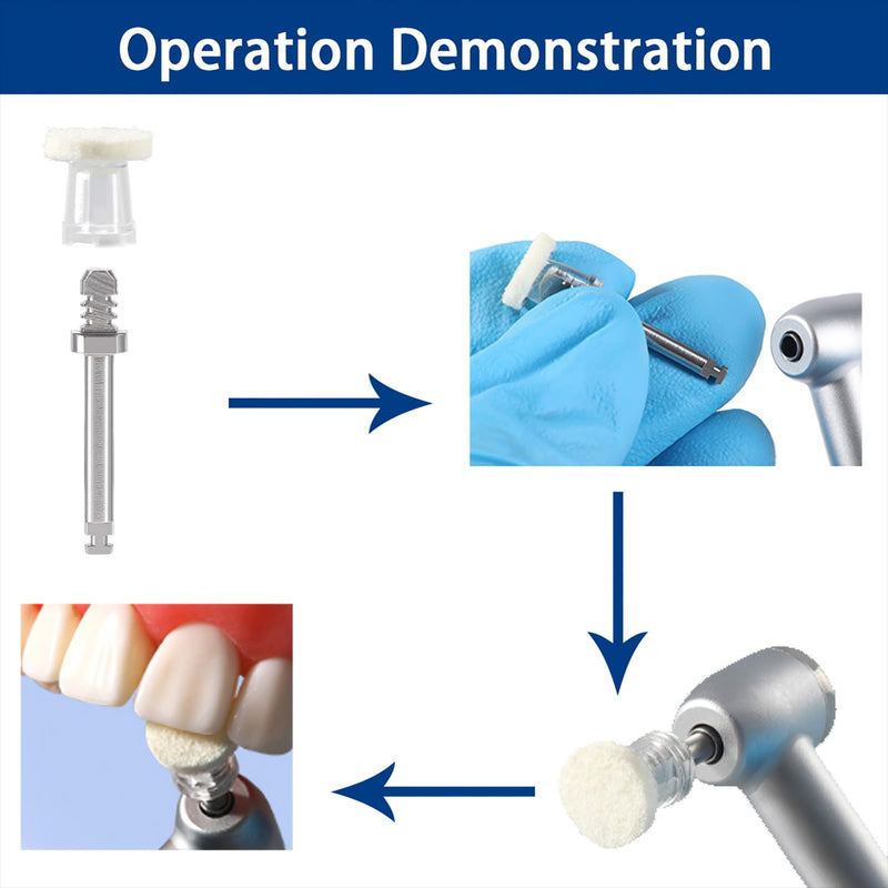 Dental Polishing Paste-Impregnated Disc, Dental Polisher Polishing Wheel Felt Finishing Disc with Mandrel for Tooth Polish Dentistry Tool