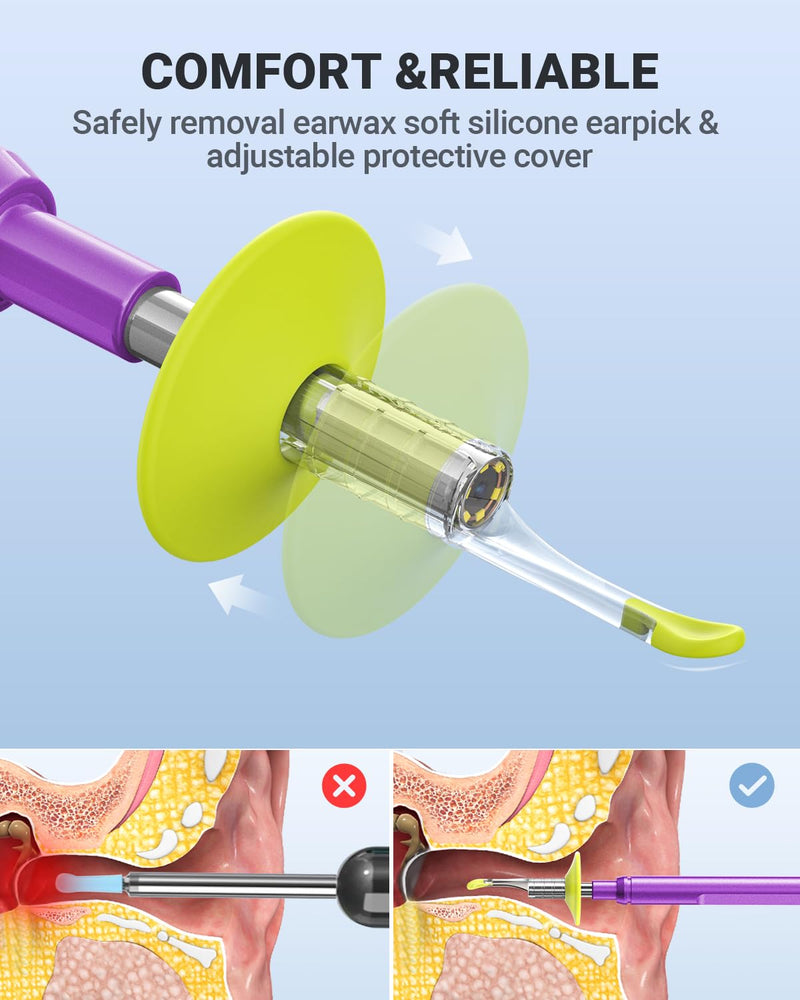 Digital Otoscope Compatible with iPhone and Android Devices, HD Ear Camera with Ear Wax Removal Tools, Video Ear Scope Otoscope with Light, Capture Photos and Videos (Purple) Purple - BeesActive Australia