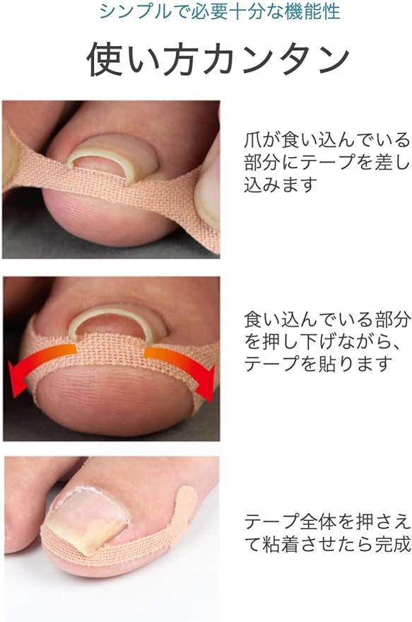 wumio Curling Nail Care Tape, Set of 20, Just Stick Support, Disposable, Wrap-around Nails, Protection Supporter, Thin, Wrap Around Thumb, Pharmacy, Simple - BeesActive Australia