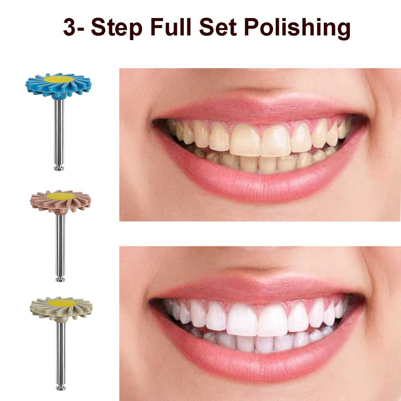 Dental Composite Resin Polishing P3 Disc Polisher Wheels Diamond 3-Step Diamond Impregnated Polishing System System 14mm Wheel Kit Spiral Flex Brush Tools P3 1.0 - BeesActive Australia