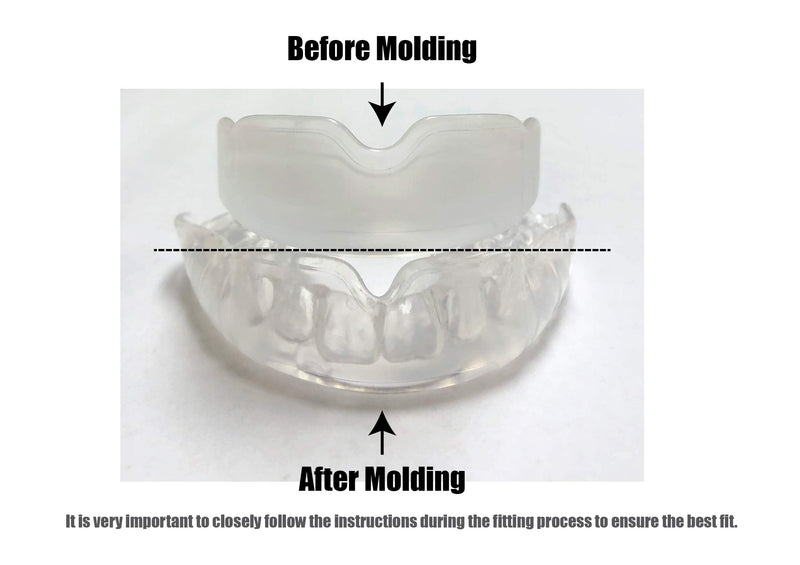 Boil and Bite Mouth Guard BB Custom Fit Sport Mouthpiece for Basketball, Karate, Martial Arts, Wrestling, MMA (Free Case Included!) -Adult Size (Adult -Ages 11 & Above, All Trans.) Adult -Ages 11 & Above Trans.