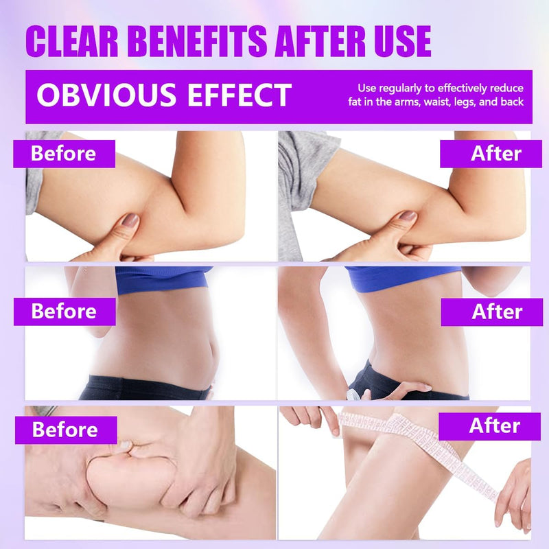 Thigh Master,Kegel Exerciser,Pelvic Floor Muscle,Pelvic Floor Exercise Devices,Thigh Master Thigh Exerciser for Women,Hip Trainer Kegel Exerciser,Pelvic Floor Trainer for Postpartum Rehabilitation - BeesActive Australia
