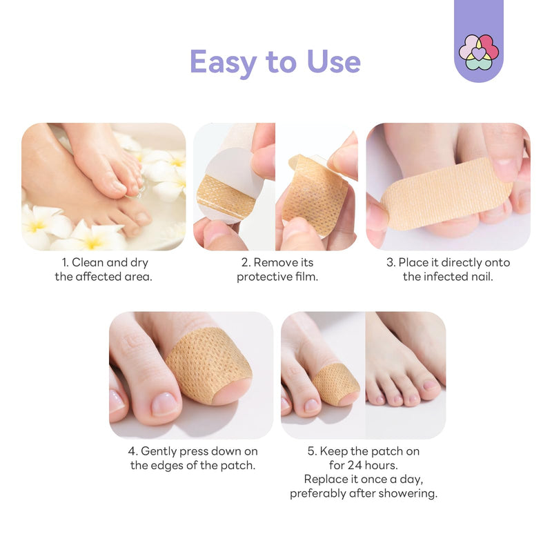SAVILAND Extra Strength Fungal Nail Patches: 8H Overnight Repair 1% Tolnaftate Toenail Treatment Nighttime Nail Renewal Restores Damaged Nails Discolored Thick Yellow Healthy Appearance 32PCS