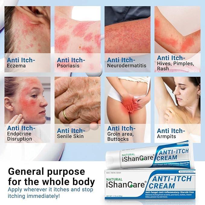 ishancare Anti Itch Soothing Cream Extra Strength Skin Itch Relief Ointment, for Full Body Itching Caused by Seasonal Changes, Dermatitis, Eczema, Rash, Psoriasis, Hives, Bites, Poison Ivy, 1.76 oz 1.76 Ounce (Pack of 1)