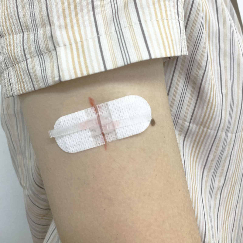 Emergency Wound Closures Adhesive Bandages, Zip Stitch Stickers for Camping, Survival & Household Gear, 3 Pcs (70 * 22mm, White) 70*22mm