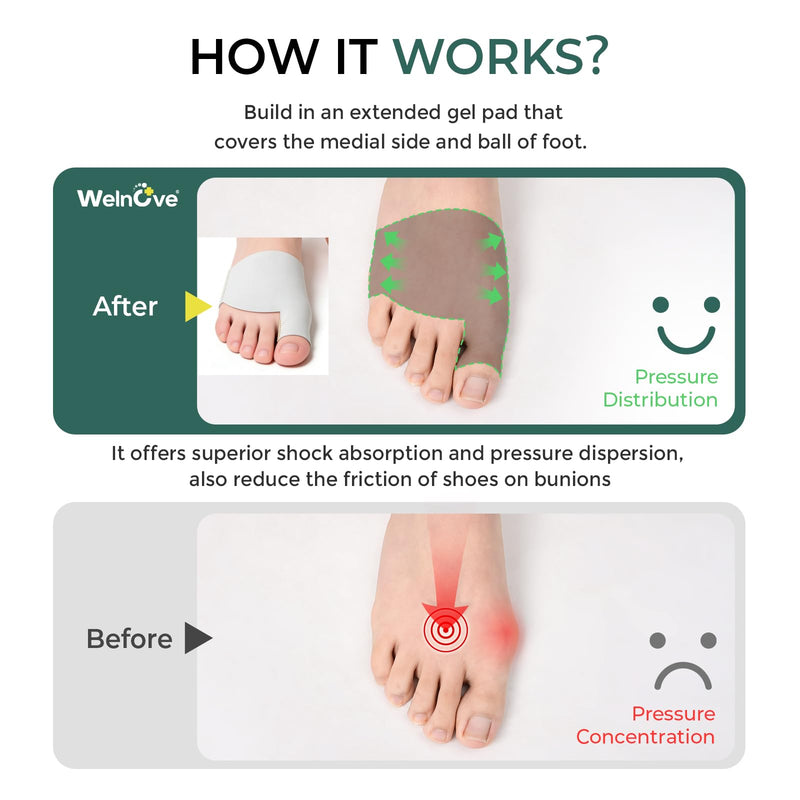 Welnove Metatarsal Pads with Bunion Relief - Upgraded Plush Lining - Ball of Foot Cushions for Metatarsalgia, Sesamoiditis, Morton's Neuroma - Forefoot Protection Sleeve with for Women Men (Size S) Gray Small