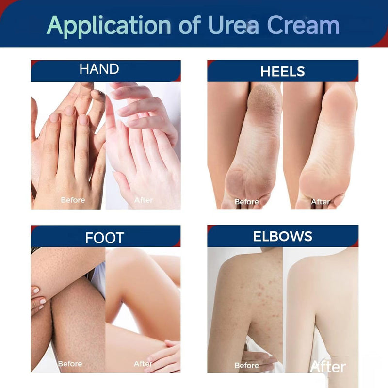 OUKEYA Urea Cream 42 Percent with 2% Salicylic Acid, 3 Oz Foot & Hand Cream for Dry Cracked Heels, Deep Moisturizing & Softening Keratin Feet Cream, Nourishing Skin Care Lotion for Rough, Dry Areas 3 Ounce( Pack of 1)