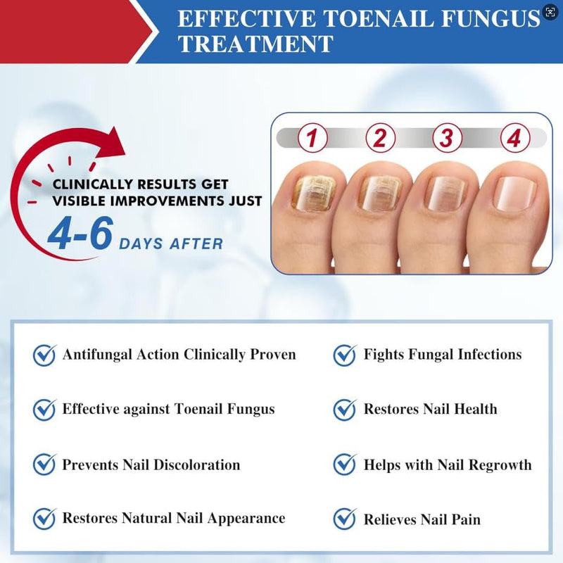 Fungal Nail Patches 60 Pcs,Upgraded Toe Nail Fungus Treatments 60 Count (Pack of 1)