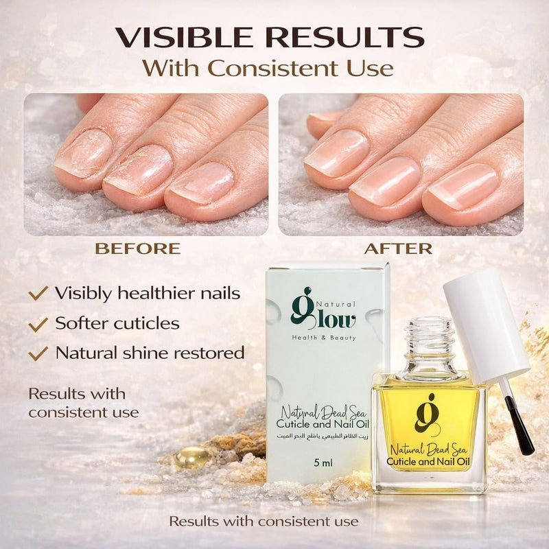 Dead Sea Cuticle & Nail Oil 5ML | Strengthens & Moisturizes Dry & Cracked Cuticles | With Almond, Olive, Argan, Jojoba & Castor Oils, Vitamin E | Nail Repair & Conditioning Oil