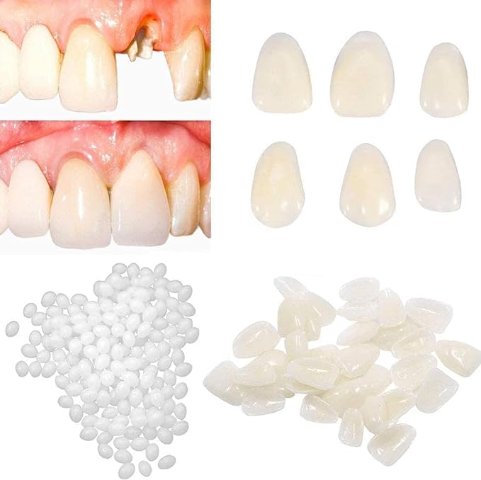 ShuaWdk Thermoplastic Resin Soft Plastic Crystal Clay DIY Consumables Funny Beads Thermal Beads Plastic Particle Repair Melting Beads Repair Multiform Pellets Can Be Used Over and Over (5g) - BeesActive Australia