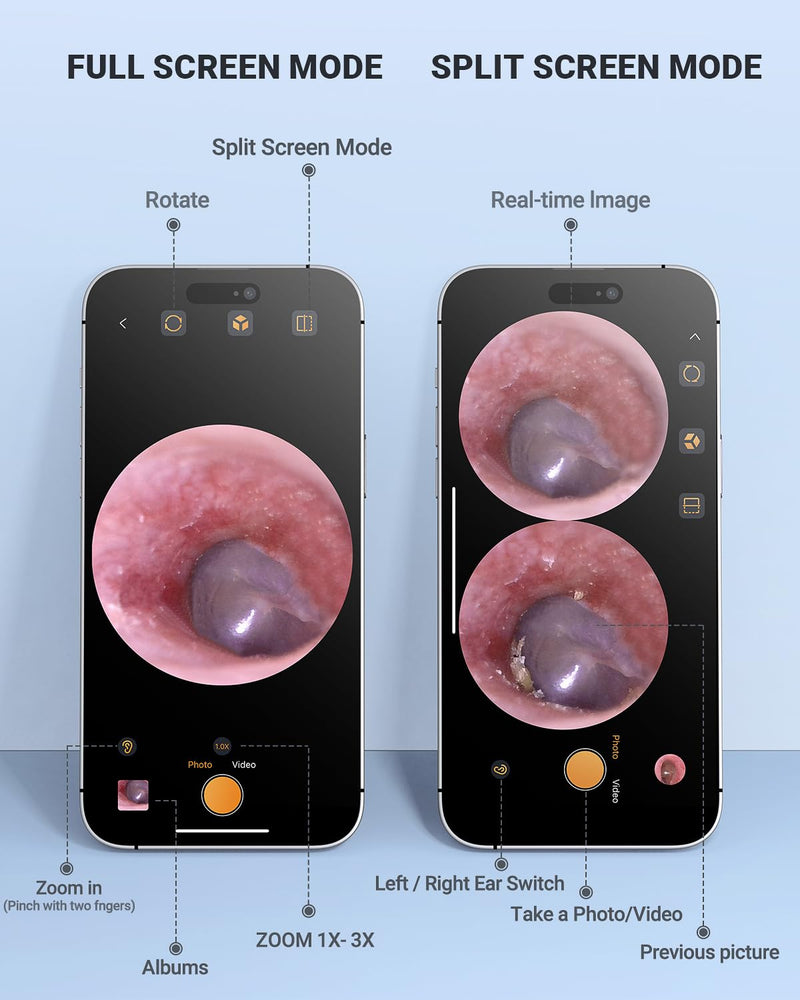 Digital Otoscope Compatible with iPhone and Android Devices, HD Ear Camera with Ear Wax Removal Tools, Video Ear Scope Otoscope with Light, Capture Photos and Videos (Purple) Purple - BeesActive Australia