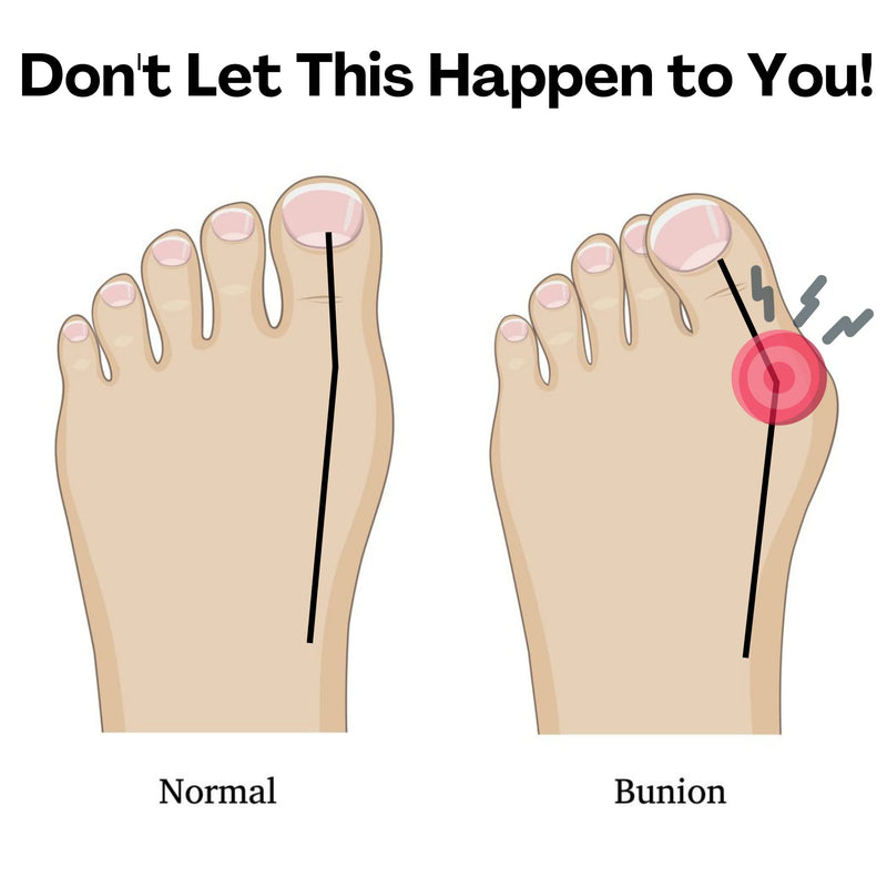 FTP Health Toe Separators - Toe Spacers - Foot Alignment - Strengthening and Balance – Correct Our Toes - For Hammertoes, Bunions, Plantar Fasciitis, Hallux Valgus – Size Medium (1 pair) - BeesActive Australia