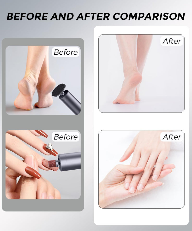 Electric Foot Callus Remover, 2-in-1 Cordless Pedicure Tools for Feet and Nail File with 80PCS Sandpaper Discs(3 Sizes), Aluminum Body with Adjustable Speed for Dead Skin, Cracked Heels & Home Carbonblack - BeesActive Australia