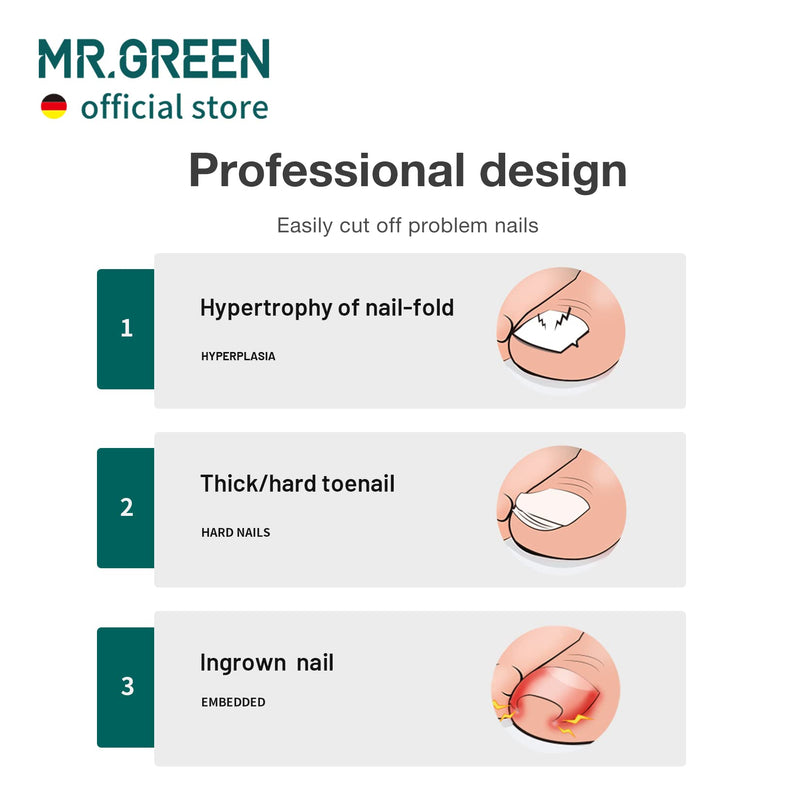 MR.GREEN Toenail Clippers Stainless Steel Ingrown Nail Cutter Thick and Hard Nails Pedicure Manicure Tools (Green+Nail Remover) Green+nail Remover - BeesActive Australia