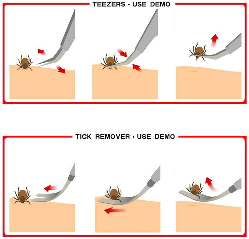 EasyULT 2 in 1 professional tick tweezers, tick tweezers and tick hook, made of high-quality stainless steel, easy to remove ticks, tick remover for humans, dogs, cats (with storage box) silver - BeesActive Australia