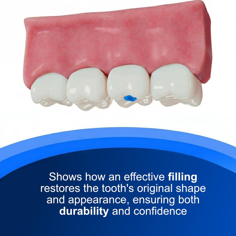 Dental Cement Kit – Zinc Oxide Eugenol Temporary Filling & Crown Repair