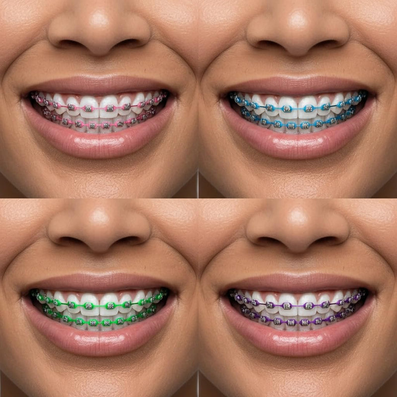 4 Rolls Power Chain for Braces with Changing Kit (Orthodontic Pliers and Probe), Continuous Rubber Braces Power chains, DIY Dental Braces Color Change at Home (Blue, Green, Pink, Purple) - BeesActive Australia