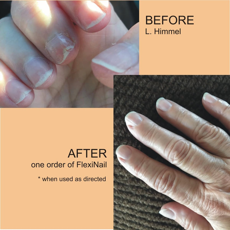 FlexiNail Penetrating Fingernail Conditioner and Strengthener. Conditioning Treatment for Peeling, Weak, Brittle & Splitting Nails | Natural Nail Repair & Growth 1 Count (Pack of 1) - BeesActive Australia