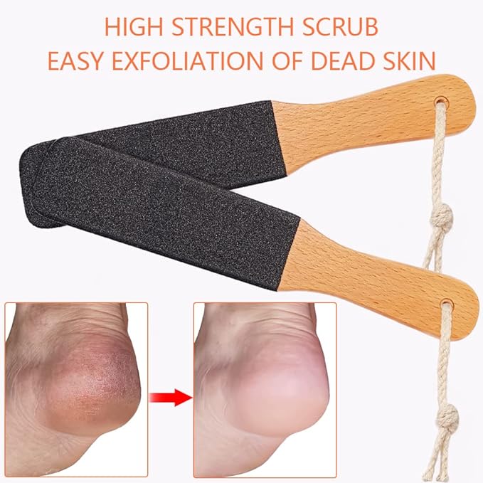 Foot Scrubber Pedicure File Tool Exfoliating for Corn and Hard Skin Calluses Pumice Stone for Feet Heels Elbows Hands - BeesActive Australia