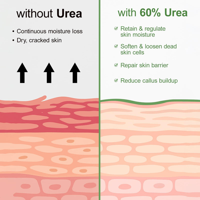 Urea Cream 60 Percent For Feet Maximum Strength Plus Salicylic Acid 2%, Tea Tree Foot Lotion For Dry Feet, Foot Cream Intensive Repair Foot Moisturizer 5.29oz 5.29 Ounce