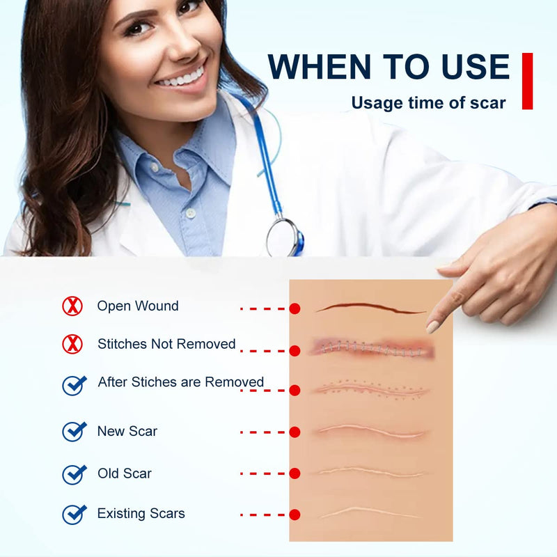 Silicone Scar Sheets Tape for Surgical Scars, C Section Scar Silicone Strips, Medical Grade, Reusable, Soften and Flattens Scars, Breast, Keloid, Professional Scar Patches. (1.8x157 Inch) 1.8x157 Inch
