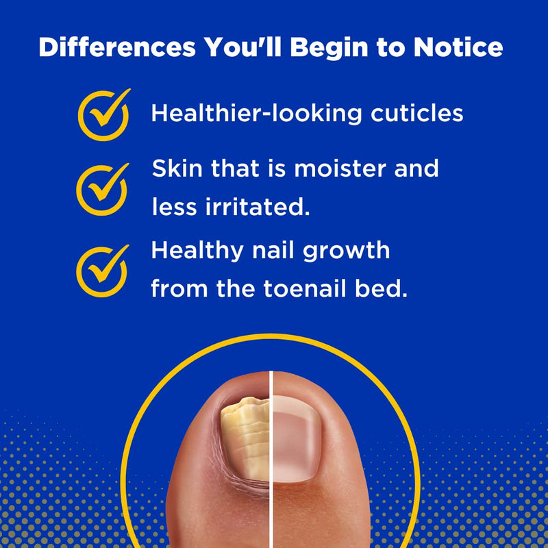 Baar Products - Toelieva Antifungal Liquid Solution - 25% Undecylenic Acid, Organic Olive Oil, Grapefruit Seed Extract - Maximum Strength - Fights Fungus Under & Around Toenails - 2 oz - BeesActive Australia
