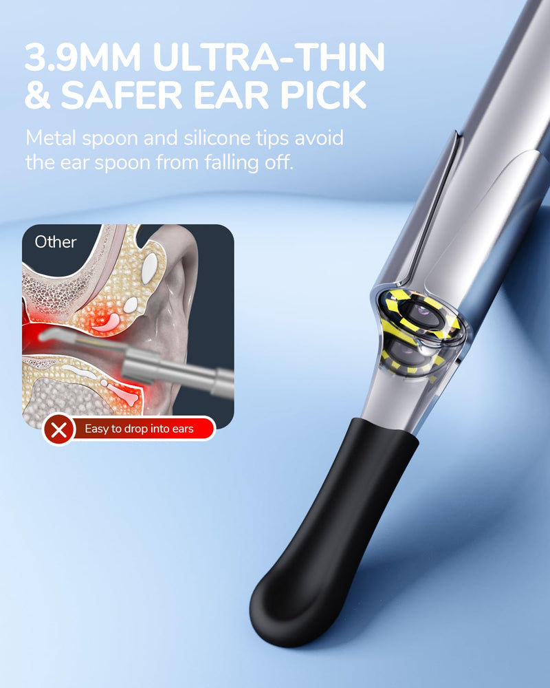 ScopeAround Otoscope with Light, 1080P FHD Ear Scope, 3.9mm Digital Otoscope Camera with 6 LED Lights Ear Wax Removal Tool Camera, Ear Scope with Light, Compatible with USB-C - BeesActive Australia