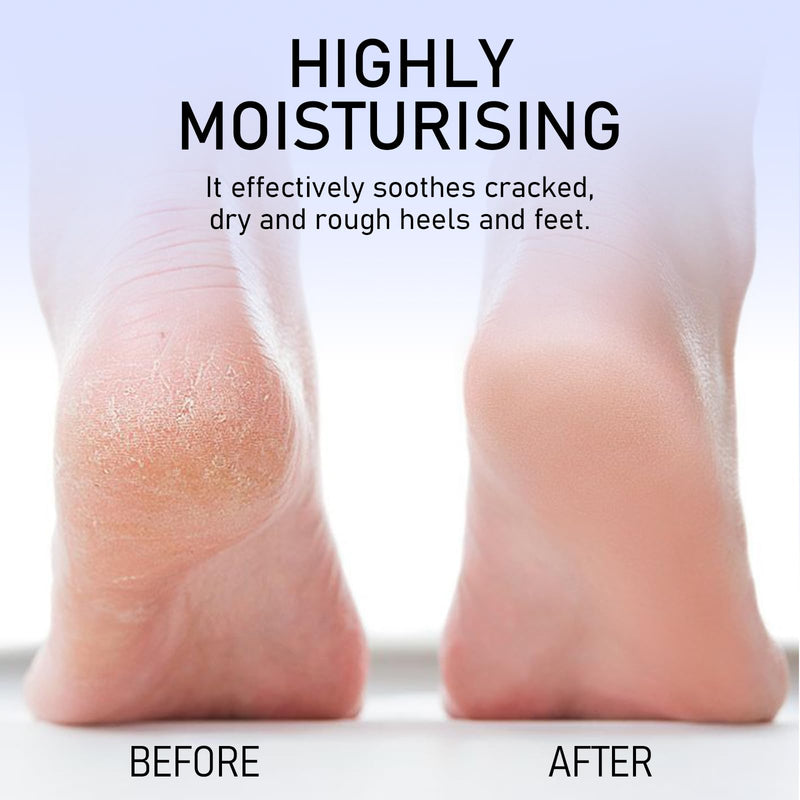 2Pcs Crack Feet Prevention Stick, Moisturizing and Hydrating Foot and Hand Balm, Remove Dead Skin Softening and Nourishing Anti-Cracking Foot Cream for Feet Elbows Knees 2pcs