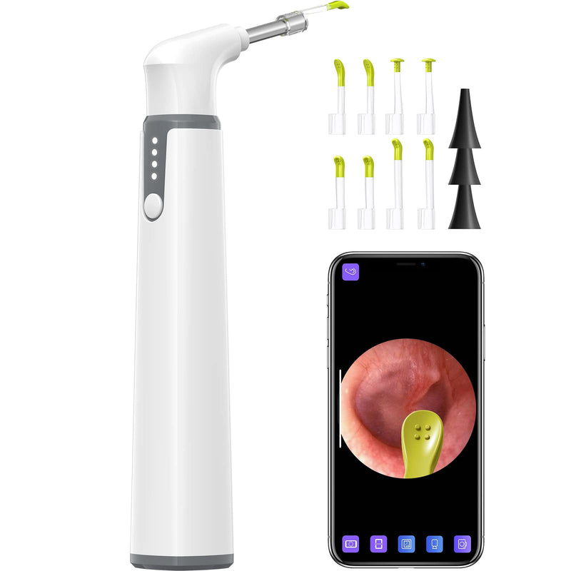 Ear Specula Set for ScopeAround Digital Otoscope, Set of 50 Pieces, Replacement Otoscope Tips, Ear Speculum, Compatible with ScopeAround SA39W/SA39i/M28/MS450 Otoscope - BeesActive Australia