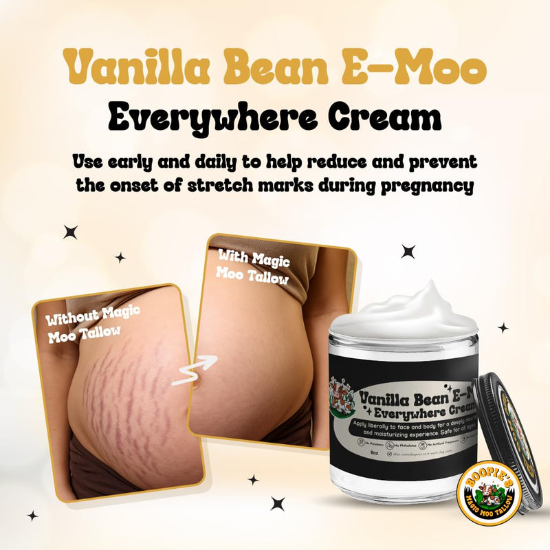 Magic Moo Beef Tallow Vanilla Bean E-Moo Moisturizing Everywhere Suet Tallow Cream with Organic Emu Oil. For Acne, Stretch Marks, Eczema, Hydration, Dry Skin & More! 2oz 2 Ounce (Pack of 1) - BeesActive Australia