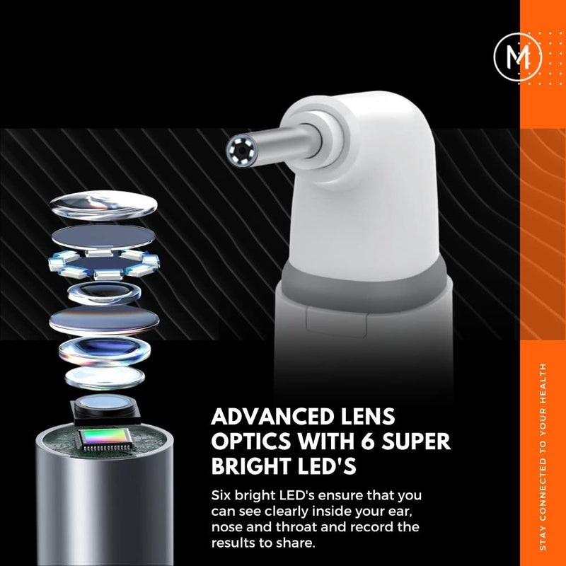 MOBI Connect Wi-Fi Otoscope for Ears, Nose & Throat - 1080P HD Lens, Multi-Axis Gyroscope, 6 LED Lights, 90+ Min Use, 3 Ear Speculum, Suitable for Adults & Children - BeesActive Australia