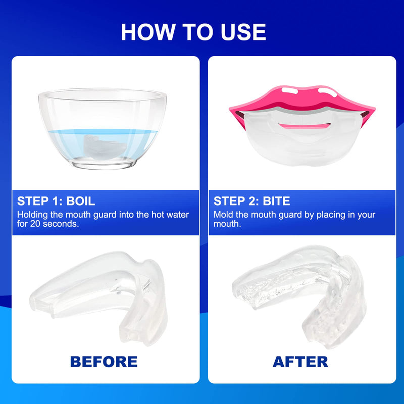 Anti-Snore Device, Anti-Snoring Mouth Guard, Snoring Solution Mouthpiece for Men and Women-J05 Clear L