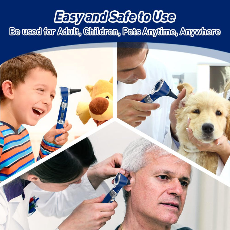 Scian Otoscope - Ear Scope with Light, Ear Infection Detector and Pocket Ear Checker Kit with 3X Magnify Lens, Suitable for Kids, Adults, Doctors, Pets(Blue) Blue - BeesActive Australia