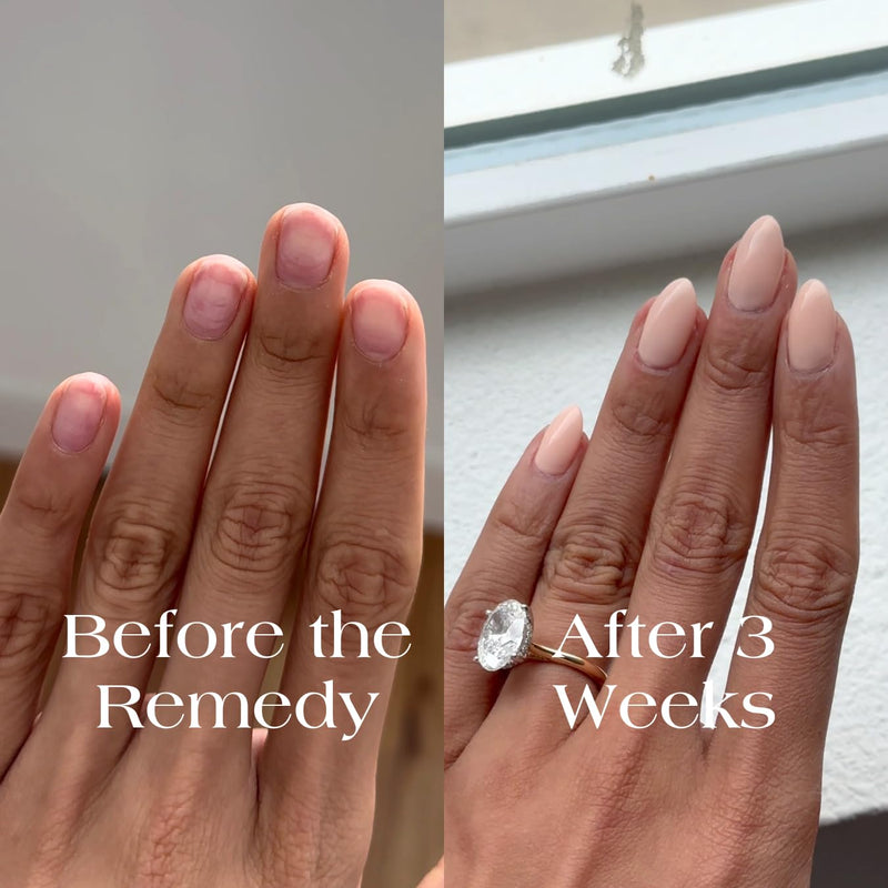 Botanist The Remedy | Nail Strengthening Polish | Repairs & Hardens Nails Damaged from Acrylics, Dip & Gel Manicures | Non-Toxic, 84% Plant Based, 21-Free & Vegan (Blush Dahlia) Blush Dahlia - BeesActive Australia