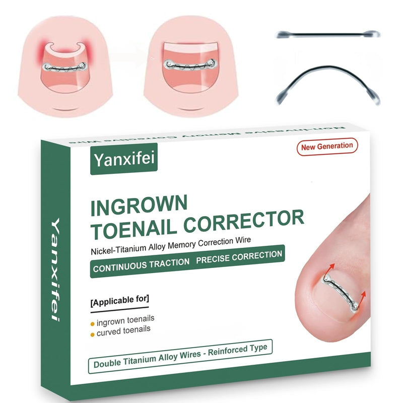 Dual Nitinol Ingrown Toenail Corrector,Ingrown Toenail Treatment,Curved Toenail Straightener,Ingrown Toenail Removal Kit,Big Toe Ingrown Toenail Tool (0.55in,0.66in) 0.55in,0.66in - BeesActive Australia