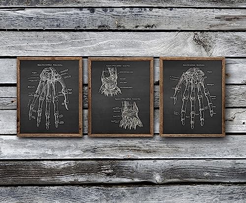 Gnosis Picture Archive Anatomy of Hand Bones Medical Educational Set of 3 Unframed Art Prints Orthopedic Office Decor